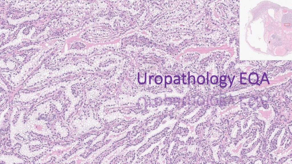 Uropathology EQA Scheme